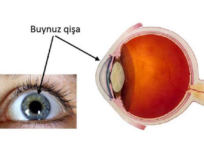 Gözün buynuz qişasının idxal və ixracı üçün tələb edilən sənədlər açıqlanıb