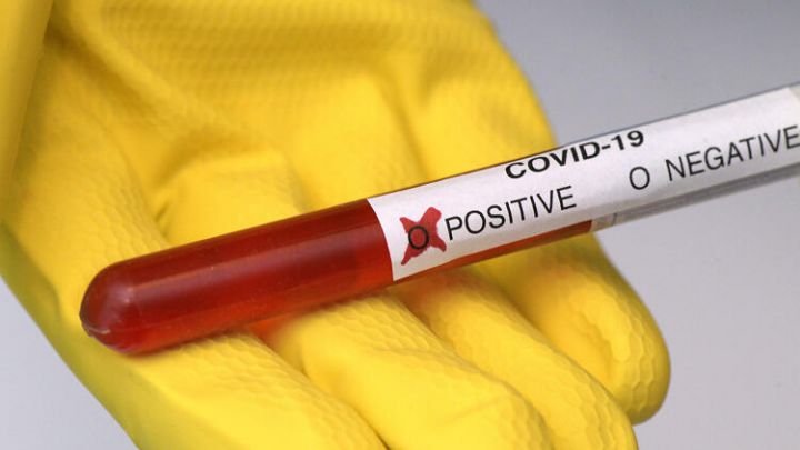 Azərbaycanda koronavirus ilə bağlı son vəziyyət açıqlandı
